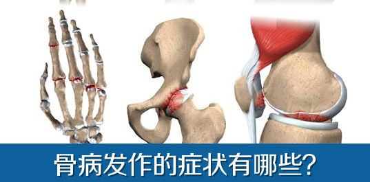 骨病有哪些症状?多一点了解，多一份希望