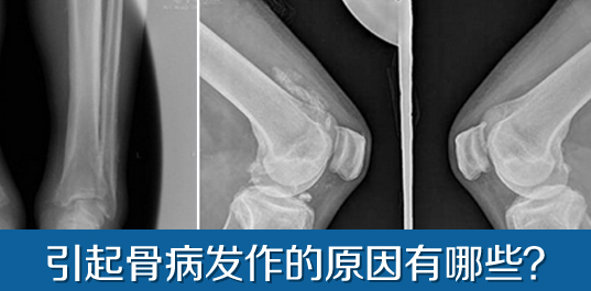 骨病的发作与什么有关